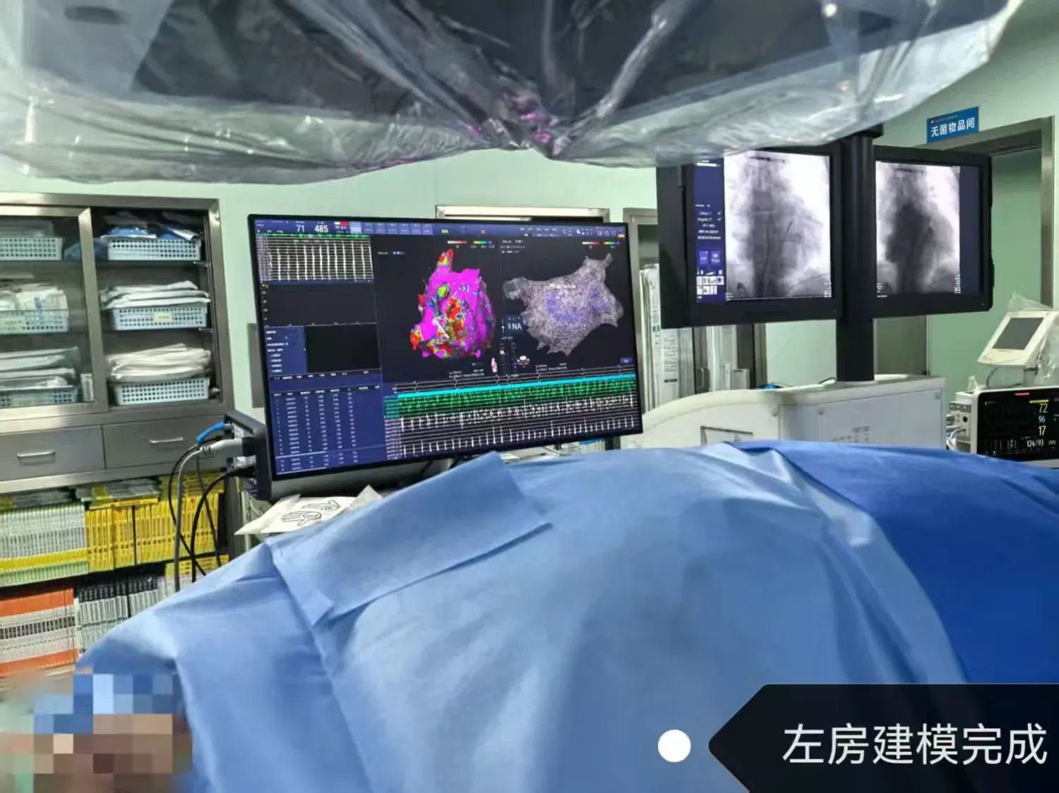 简篇-再添天团级教授帮扶，科室建设迈入快车道——蓝田县中医医院心病科团队成功完成县域内第二例房颤脉冲电场消融术