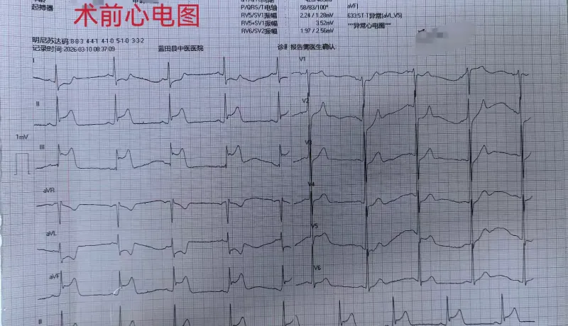 简篇-【蓝中医—心病科】当急性心梗心源性休克遭遇冠脉开口异常，看我们如何力挽狂澜