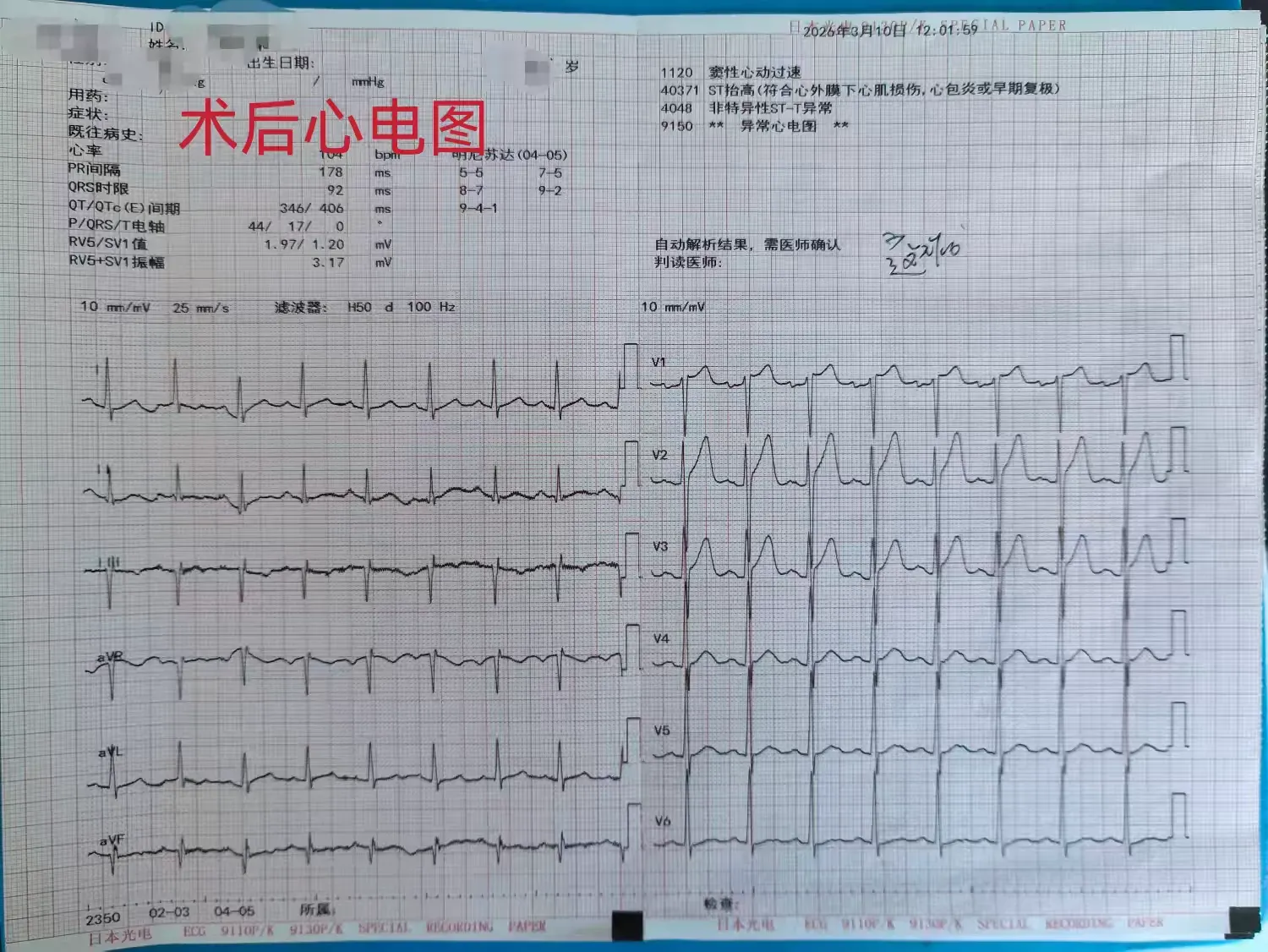 简篇-【蓝中医—心病科】当急性心梗心源性休克遭遇冠脉开口异常，看我们如何力挽狂澜